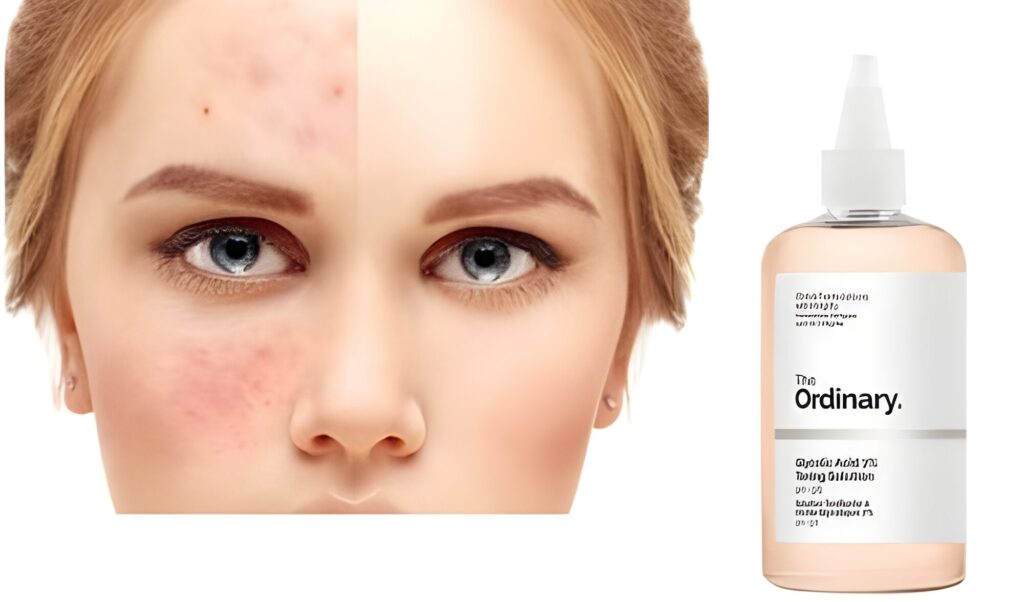The Ordinary Glycolic Acid 7% Toning Solution